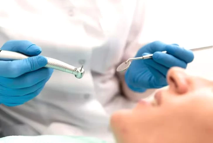 torno-odontologo-caries-728x491